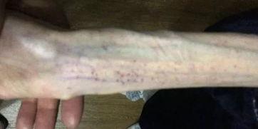 4个月引产吃瓜视频