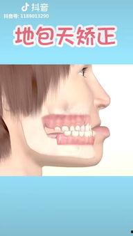 吃瓜对牙齿有影响吗视频,吃瓜对牙齿健康的潜在影响揭秘